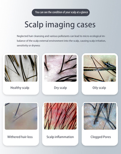 Factory Sale 3-in-1 Scalp <b>Analysis</b> 3D Topography AI Technology <b>Skin</b> Analyzer with 1 Year Warranty for Commercial Use - Product Image 4