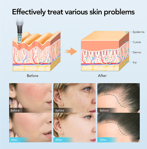 Dispositivo de Microagujas <span class=keywords><strong>Dr</strong></span>.<span class=keywords><strong>pen</strong></span> <span class=keywords><strong>M7</strong></span>, Dermapen para Microagujas - Product Image 6