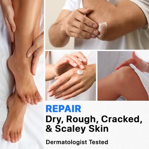 Marque privée Crème à l'urée 40% Acide salicylique 2% Crème pour les pieds à l'huile d'arbre à thé pour les talons craquelés secs Pieds Genoux Coudes Mains - Product Image 2