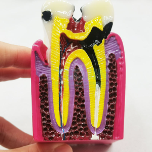 Modello Comparativo di Denti con 6 Volte Più Danni, Modello di Denti in Resina Dentale Smontabile - Product Image 5