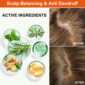 Crema Anticaspa Nutritiva para el Cuero Cabelludo, Control de Grasa, Mezcla Antifúngica, Despierta los Cuero Cabelludos Secos, Elimina las Escamas, Retiene la Humedad - Product Image 3