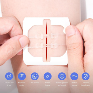 Tiras Adhesivas Estériles para Cierre de Heridas YOJO PU, Impermeables, para Incisiones Quirúrgicas, Laceraciones y Cuidado de Heridas - Product Image 2