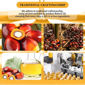 Olio di Batana per la crescita dei capelli Spray lasciare nel siero balsamo per le donne gli uomini addensare idratare rafforzare il <span class=keywords><strong>trattamento</strong></span> del cuoio capelluto olio per capelli - Product Image 3