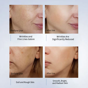 Private Label Coreano Cosméticos Produtos De Cuidados Com A Pele Anti Envelhecimento Caracol Mucina Colágeno Rosto Soro Facial Essência Creme Skincare Set - Product Image 6