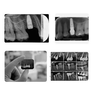 XIEJIAN MC <span class=keywords><strong>Ray</strong></span> V Smart <span class=keywords><strong>Ray</strong></span> <span class=keywords><strong>X</strong></span> Alternativa, Cono de Plástico para Radiografía <span class=keywords><strong>Dental</strong></span>, Fuente de Alimentación Eléctrica, Certificado CE Clase II Europeo - Product Image 6