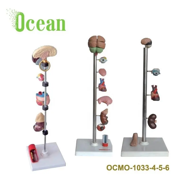 Hypertension model in medical science for teaching medical model for Demonstration