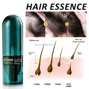 OTVENA <span class=keywords><strong>Meilleur</strong></span> <span class=keywords><strong>sérum</strong></span> en spray pour la croissance des cheveux biologique Réduire la perte de cheveux Favoriser la croissance des cheveux Essence - Product Image 3