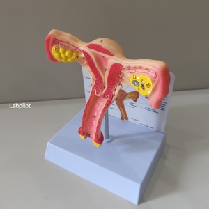 Simulador de Útero Labpilot, Maniquí de Demostración Médica, Modelo de Lesión Cervical, Entrenamiento Anatómico Escolar, Plástico PVC LP/ZG - Product Image 2