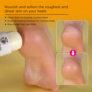 Stick de soin des pieds à l'huile de cheval, emballage personnalisé, réparation des talons fissurés, crème hydratante pour les mains et les pieds - Product Image 2