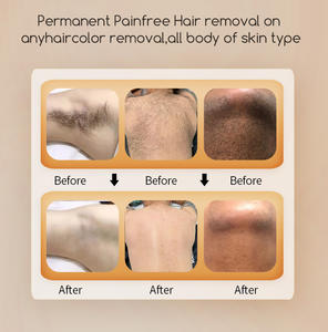 Machine professionnelle d'épilation au <span class=keywords><strong>laser</strong></span> à diode avec longueurs d'onde 808 nm et 1064 nm, système de refroidissement, blanchiment pour usage commercial - Product Image 4