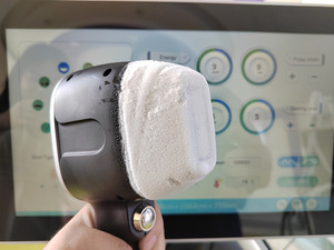 Máquina de Depilación Láser de Diodo de 2000W y 808nm para Uso Profesional en Salón, Equipo de Depilación Permanente con Sistema de Superenfriamiento - Product Image 6