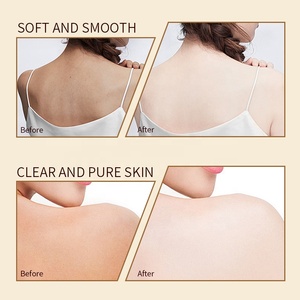 Gel douche de haute qualité nettoyant pour le corps soufre <span class=keywords><strong>Anti</strong></span>-acariens nettoyage en profondeur contrôle de l'huile hydratant blanchissant Gel douche exfoliant OEM - Product Image 5