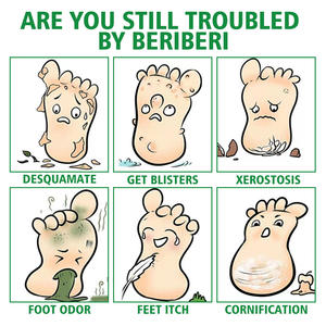 Спрей для ухода за ногами, 30 мл - Product Image 3