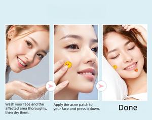 Patchs colorés imperméables et invisibles pour couvrir les imperfections et les boutons, traitement de l'acné pour le visage et le corps - Product Image 4