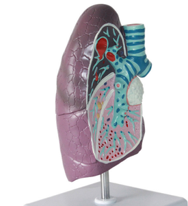 عينة نموذج رئة باثولوجي بشري من أعضاء حشوية الرئة للمدخنين المحاكاة تعليم الجهاز التنفسي لجراحة الصدر - Product Image 5