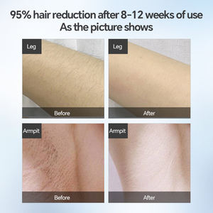 Máquina IPL Doméstica MLAY T10 para Remoção de Pelos Permanente e Indolor, <span class=keywords><strong>Laser</strong></span> de Safira para Soprano Ice, Tendência Agora - Ice Sapphire La - Product Image 3