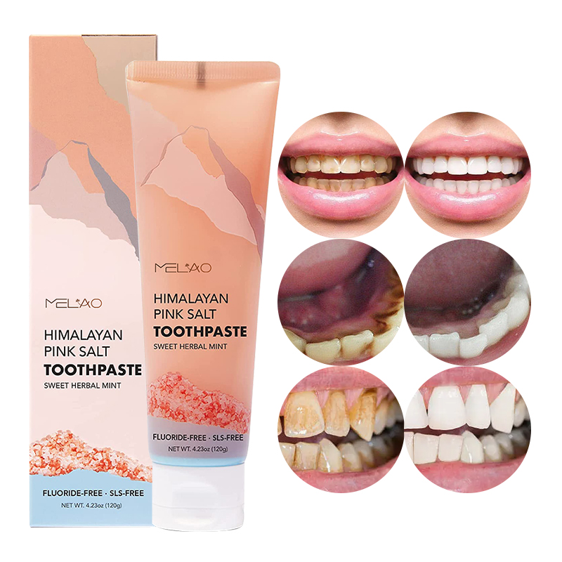 OEM зубная Базовая отбеливающая зубная паста с мятным вкусом, антиполостная розовая зубная паста для чувствительных зубов