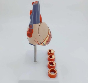Modelo <span class=keywords><strong>de</strong></span> Corazón con Trombosis - Product Image 3