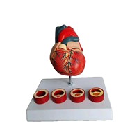 Modelo de Enseñanza Médica de Corazón con Trombosis, Simulador Realista de Patología Cardíaca para Entrenamiento de Cardiología CE/ISO