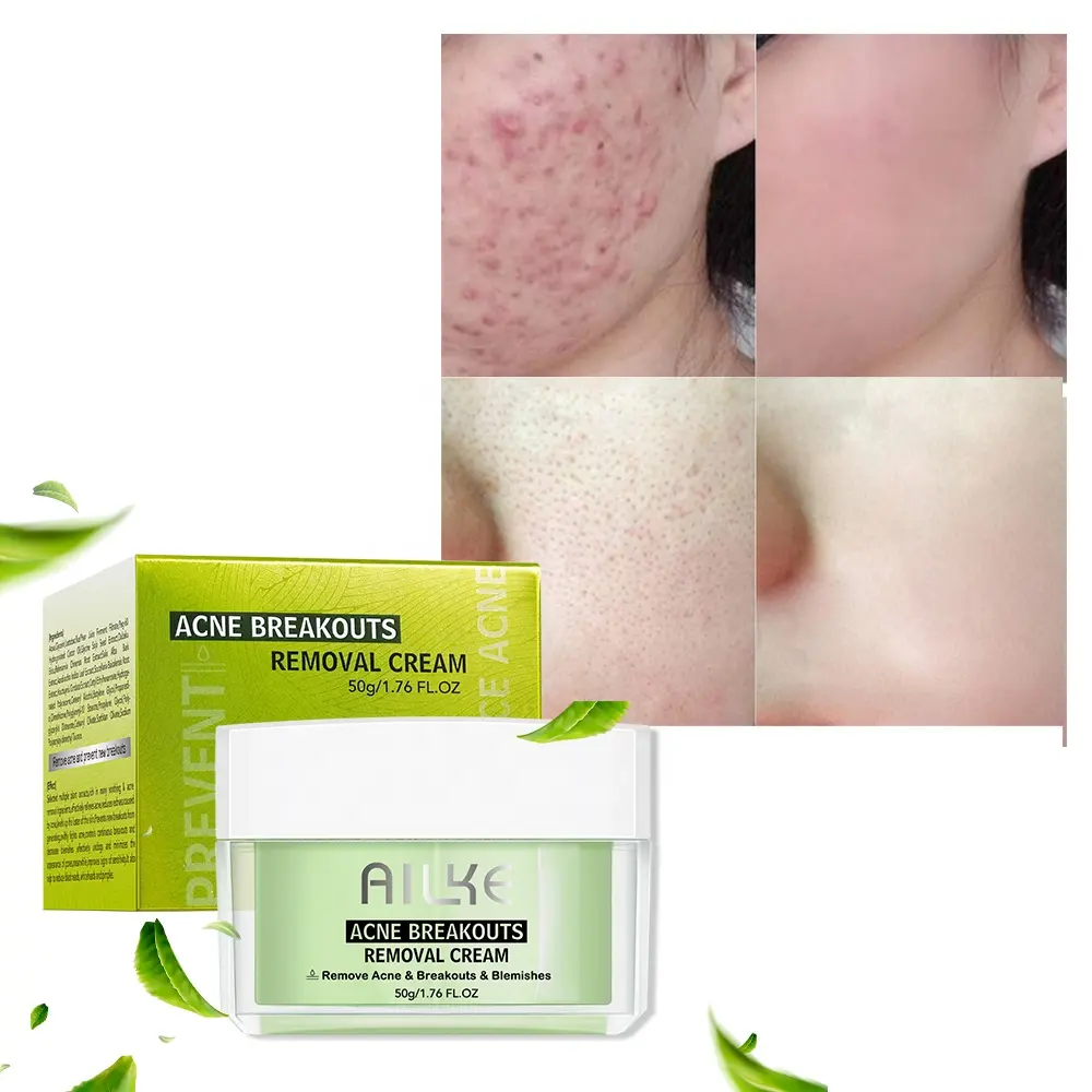 Alike Atacado Blackhead Aha Beleza Rosto Fresco Iluminamento Noite Anti Acne Tratamento Creme Para Homens