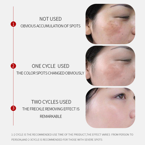 <span class=keywords><strong>Crema</strong></span> Facial Blanqueadora y Anti-Manchas BEOTUA para el Cuidado Facial Femenino, <span class=keywords><strong>Crema</strong></span> Reparadora Facial OEM/ODM - Product Image 5