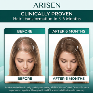 OEM Haar groeisupplementen voor vrouwen, klinisch bewezen voor zichtbaar voller haar en betere hoofdhuiddekking - Product Image 2