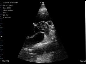 Minbrand marka prob 192 eleman 3 in 1 çift kafa kablosuz prob ultrason kablosuz renkli Doppler 3 in 1 prob - Product Image 5