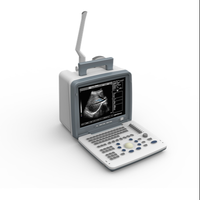 Escáner de Ultrasonido Portátil B/N 2D para Hospitales Médicos y Veterinarios