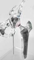 Modèle transparent d'implant de joint de hanche, modèle de remplacement, taille mini, modèle de présentation générique transparent