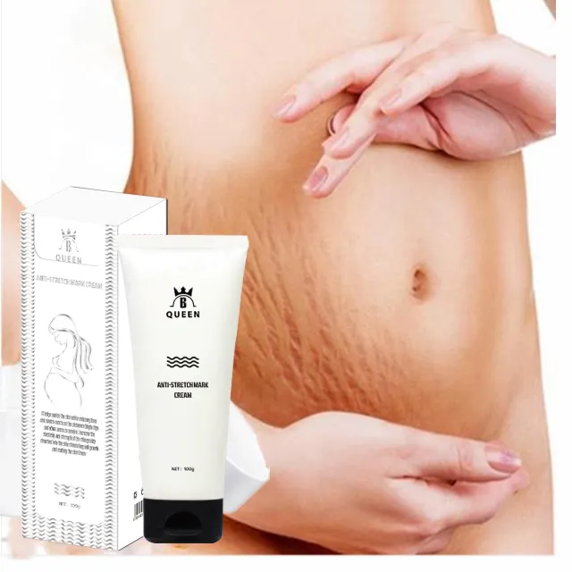 2021 best sell anti stretch marks cream removal skin stretch mark with wholesale price