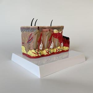 Modello Anatomico di Bruciature Cutanee con Codifica a Colori per Tessuti Normali e Bruciature di Terzo Grado, Modello Didattico per l'Educazione in Dermatologia - Product Image 3
