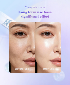 Siero Professionale per la Cura della Pelle, Siero alla Vitamina C per Luminosità del Viso e Correzione delle Macchie Scure - Product Image 4