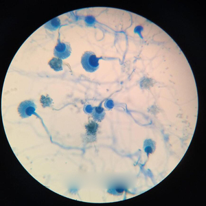Portaobjetos de Microscopio con Algas y <span class=keywords><strong>Hongos</strong></span> para la Enseñanza de Biología en Secundaria, Especímenes Preparados con Estructuras Fúngicas Típicas, ISO - Product Image 5
