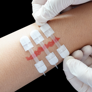 Zip Stitches Bandes de fermeture de plaie Kit de fermeture de lacération pour plaies, soulagement de la douleur pour enfants et adultes - Product Image 4