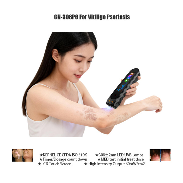 Professional Excimer Laser Phototherapy Machine CN-308P6 with 308nm LED UVB Lamp for Skin Diseases Treatment CE USA 510K Approve