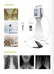 เครื่องเอกซ์เรย์แบบพกพาเครื่องเอกซเรย์ระบบดิจิทัล5KW ใหม่ - Product Image 6