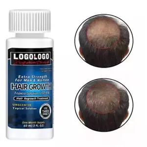 Óleo de tratamento capilar 60ml, agente de crescimento do cabelo 5%, evita a perda de cabelo, soro nutritivo para crescimento, terra de Kirk, 6 unidades