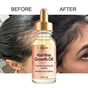 Sérum Huile Capillaire Oalen à la Biotine pour la Croissance des <span class=keywords><strong>Cheveux</strong></span> et Traitement Anti-Chute, pour des <span class=keywords><strong>Cheveux</strong></span> Plus Épais et une <span class=keywords><strong>Repousse</strong></span> Rapide de la Barbe - Product Image 1
