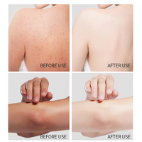 UUKKG 1000ML Huile de Bain Nettoyante Profonde Végétalienne à l'Acide Kojique et Niacinamide, Huile Corporelle Hydratante Éclaircissante et Adoucissante pour Massage et Soin de la Peau