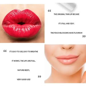 Voluminizador de Labios Eléctrico Recargable por USB, Portátil, para Uso en Salones de Belleza, Equipo para Aumentar el Volumen de Labios - Product Image 4