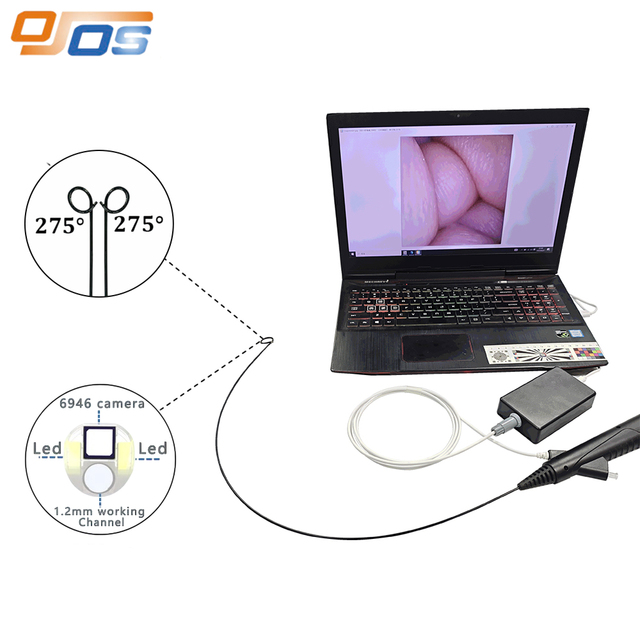 Flexible and Disposable Ureteroscope Endoscope Wholesale Medical Flexible Veterinary Endoscope with Mini Camera