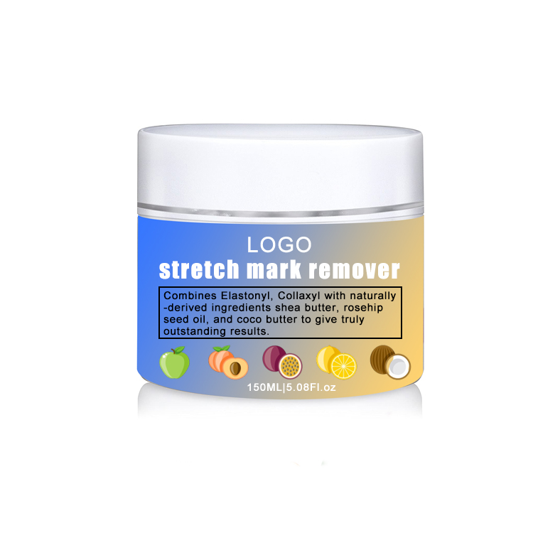 Pregnancy Stretch Mark Repair Cream Maternity Obesity Skin Postpartum Stretch Scar Body Marks Remover Smooth Skin Care