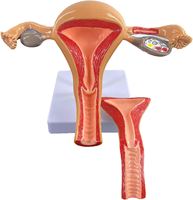 KyrenMed Modèle d'ovaire d'utérus normal féminin humain avec couverture Modèle d'organe reproducteur d'utérus et d'organes génitaux Simulation de gynécologie