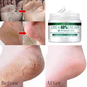 Crème à l'urée en gros pour les pieds, hydratante, éliminant les peaux mortes, réparatrice <span class=keywords><strong>antifongique</strong></span> et prévenant la sécheresse et les gerçures - Product Image 2