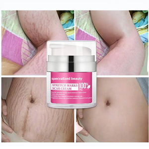 Crema Corporal para el Cuidado de Estrías Piel Negra Vegana Colágeno Natural para Vientre Firme Muslos Internos y Brazos Loción para Eliminar Estrías - Product Image 2