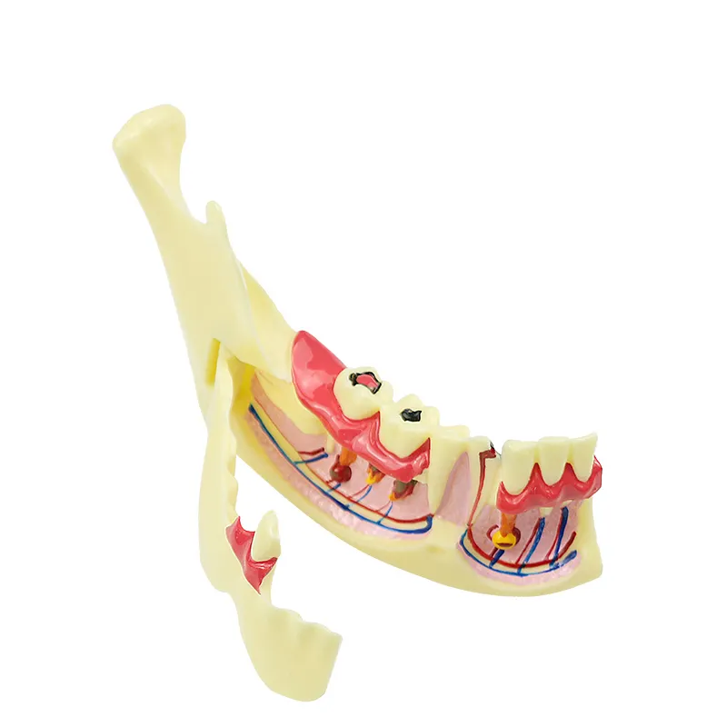 人間の歯モデル歯科内治療モデル歯茎の解剖学歯科研究教える歯モデル