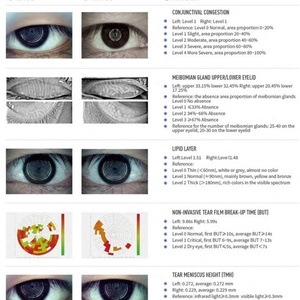 Analyseur de surface oculaire non invasif, analyseur automatique de la sécheresse oculaire pour un examen complet de la sécheresse oculaire DEA60 - Product Image 6