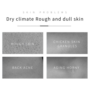 Gommage au charbon actif OEM, nettoyage en profondeur du corps et du visage, exfoliant, éliminateur de points noirs, gommage <span class=keywords><strong>d</strong></span>étoxifiant pour peaux grasses, marque privée - Product Image 3