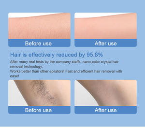 Cristal épilateur Cristal, Gomme à cheveux, outil d'épilation physique, Pierre blanche, épilation, Gomme dépilatoire - Product Image 6