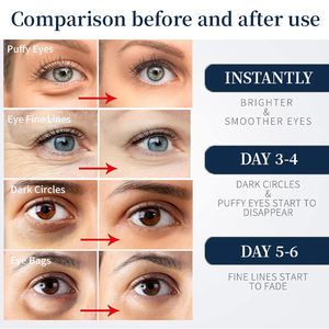 Parches de Gel Bio Orgánicos Veganos con Infusión de Hierbas, Ácido Hialurónico y Colágeno, Mascarilla de Ojos de Cristal, Venta al por Mayor, Antiarrugas, Reafirmante, para Piel Seca - Product Image 5